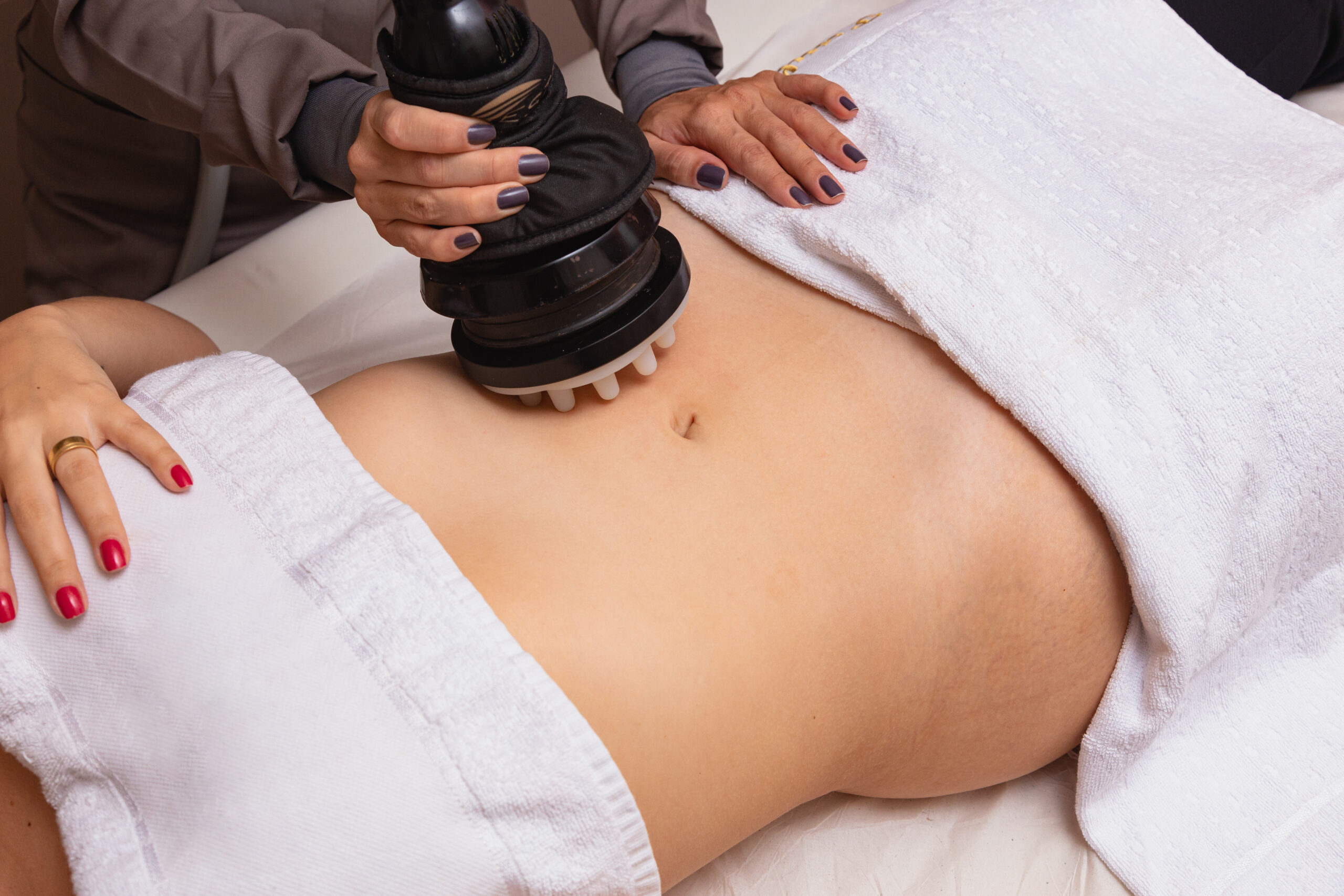 Aesthetic belly treatment with vibrocel